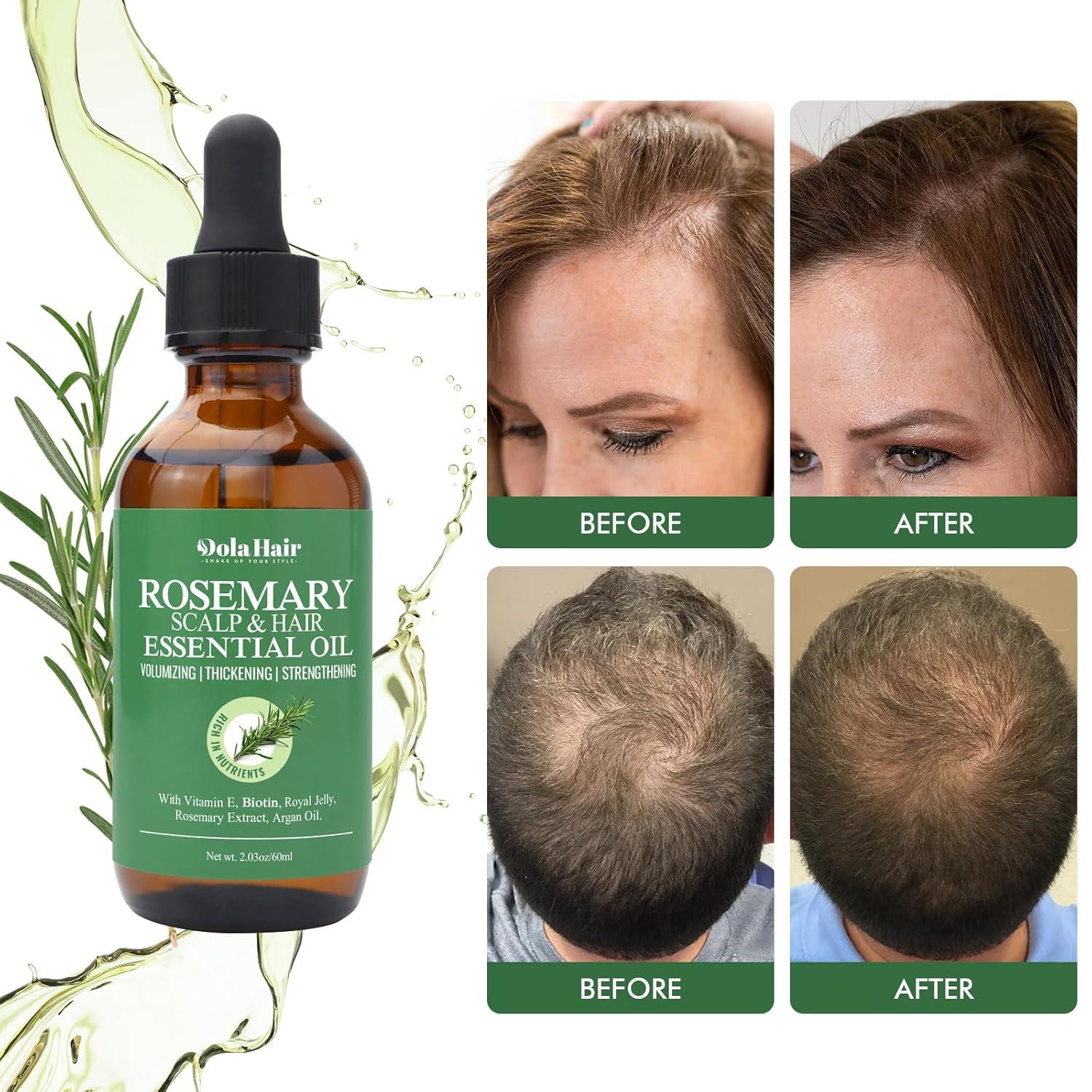imageOrganic Essential Rosemary Oil for Hair Growth Thin Hair Healthy Scalp and Skin 203 Oz203 Oz Rosemary Oil